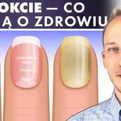 Jak wygląda zdrowy paznokieć? Oto cechy, które musisz znać
