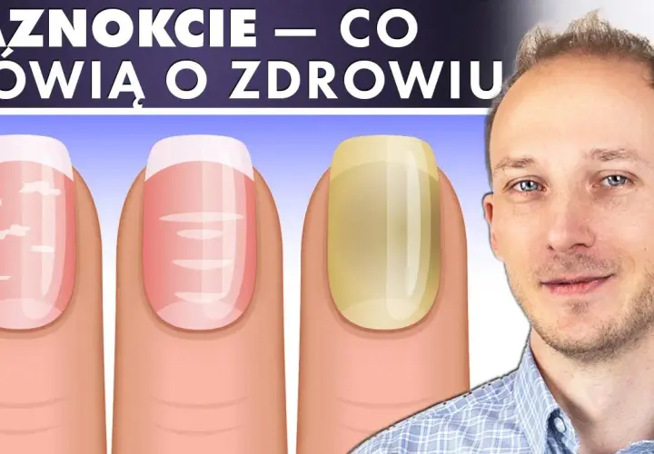 Jak wygląda zdrowy paznokieć? Oto cechy, które musisz znać