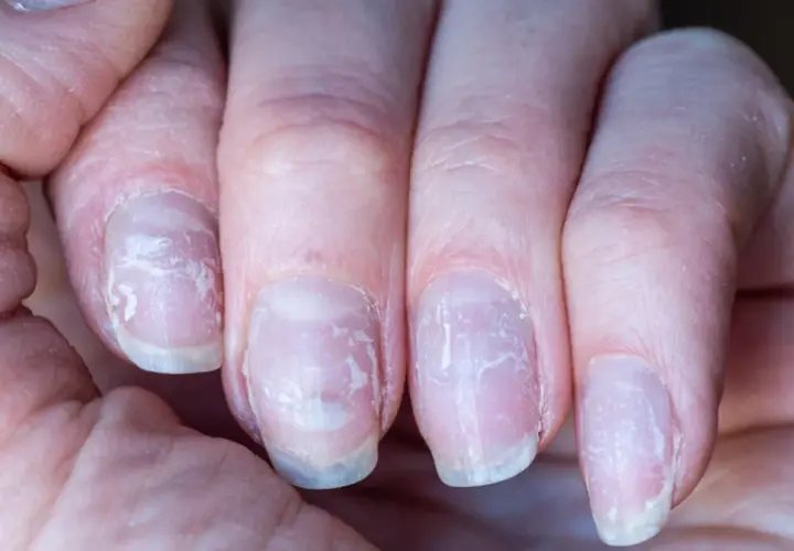 Manicure japoński: kiedy najlepiej zrobić po hybrydzie dla zdrowia paznokci