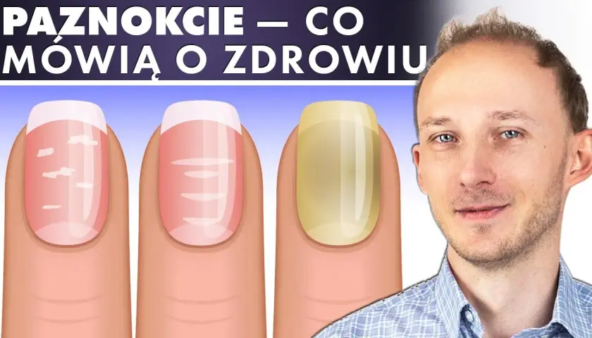 Jak wygląda zdrowy paznokieć? Oto cechy, które musisz znać