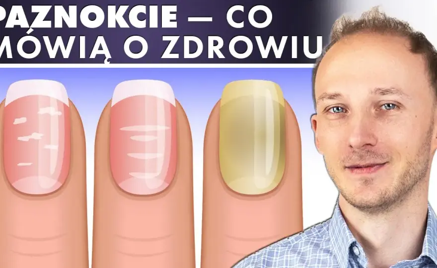 Jak wygląda zdrowy paznokieć? Oto cechy, które musisz znać